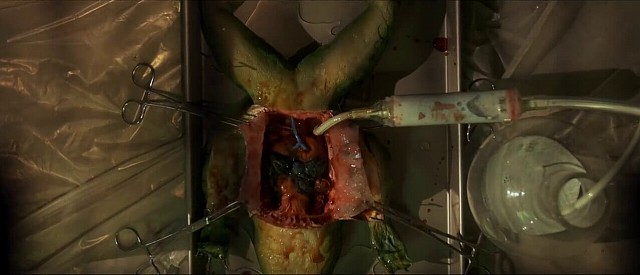 News_2015-01.htm#BadBlood